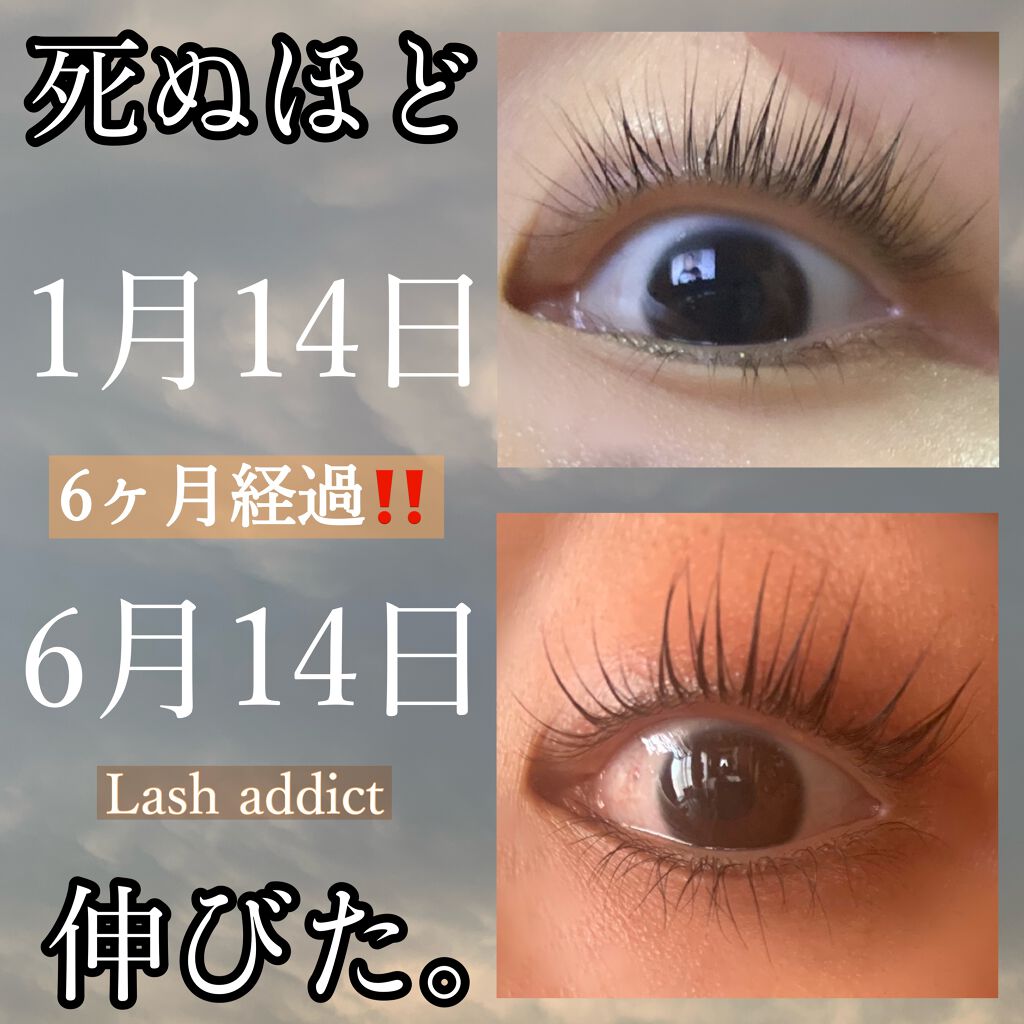 まつげ美容液 ラッシュアディクト Lashaddict 5ml - 基礎化粧品