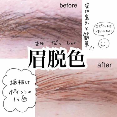 年代 肌質別 脱色クリーム敏感肌用 エピラットの口コミ 435件 Lips