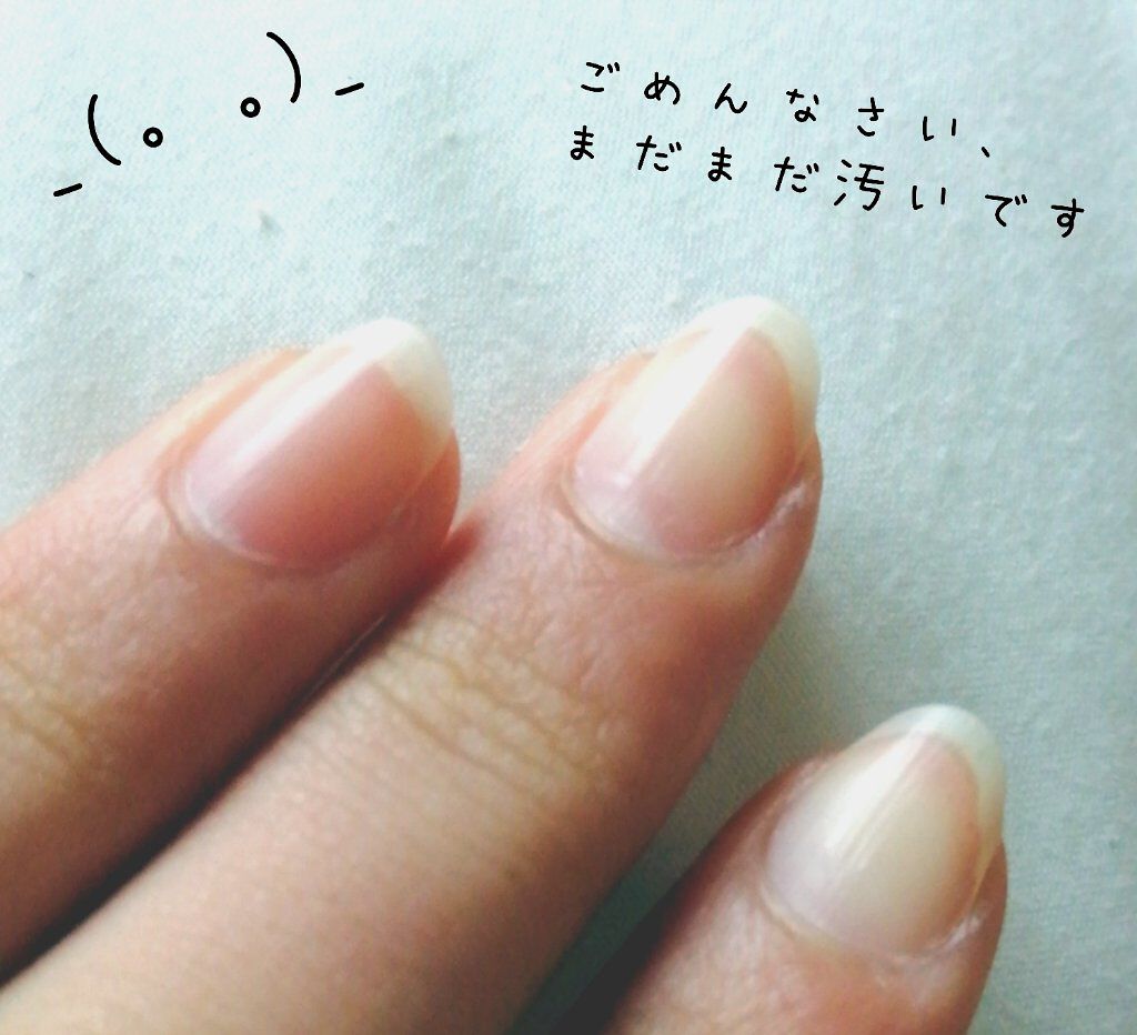 スージング モイスチャーアロエゲル ネイチャーリパブリックを使った口コミ みなさん ちゃんと爪の手入れしてますか By Nico 10代後半 Lips