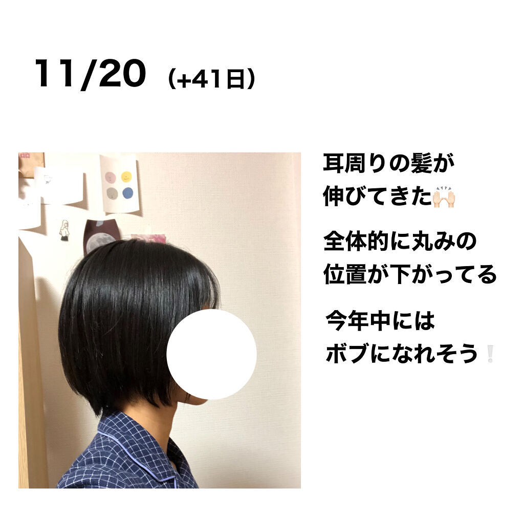 Hairworthy サプリメント 髪の伸び 長い髪 男性用育毛剤 Www Clinicaindicare Com Br