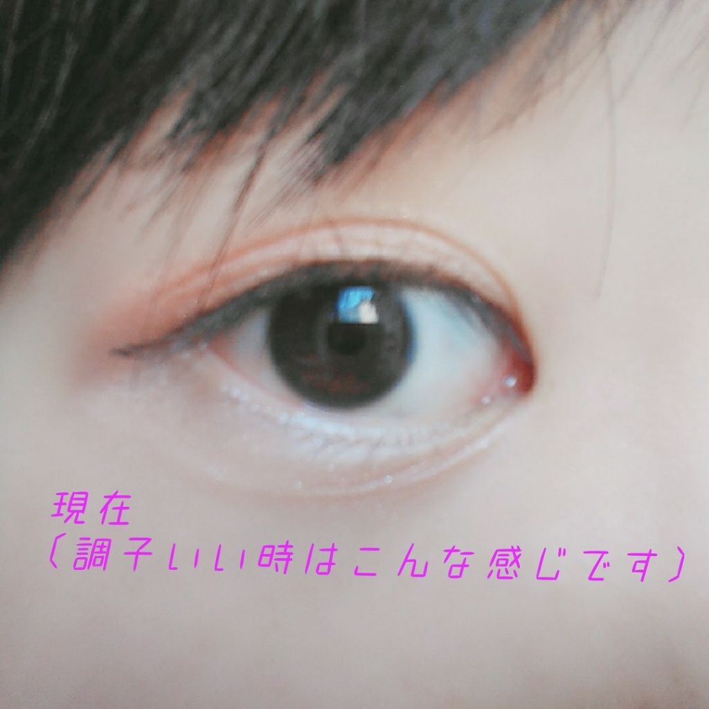 二重になる方法 アイトーク アイトークの使い方や二重メイク 私 By サン 普通肌 10代後半 Lips