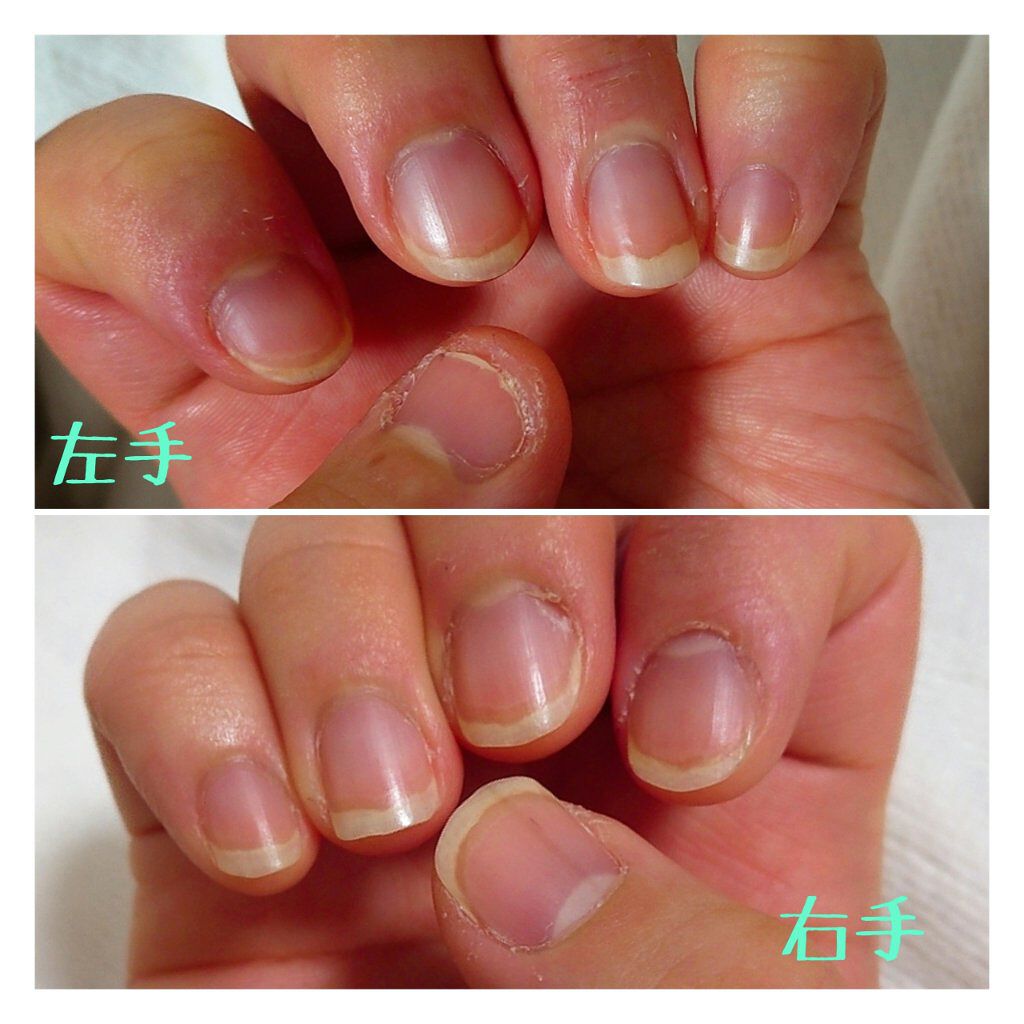 ネイルホリック キューティクルオイル ネイルホリックの口コミ Nailholicキューティクルオイル5m By Tomoe 敏感肌 Lips