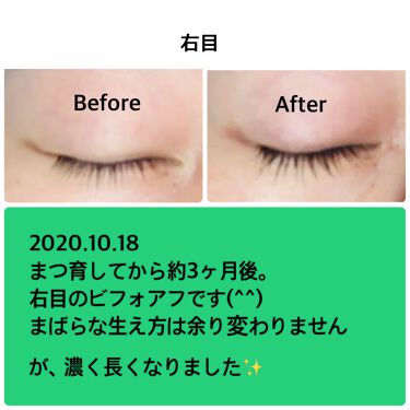 エグータム アルマダスタイルの効果に関する口コミ 本当に伸びた まつ毛美容液 エグータム By Tohico 混合肌 30代前半 Lips