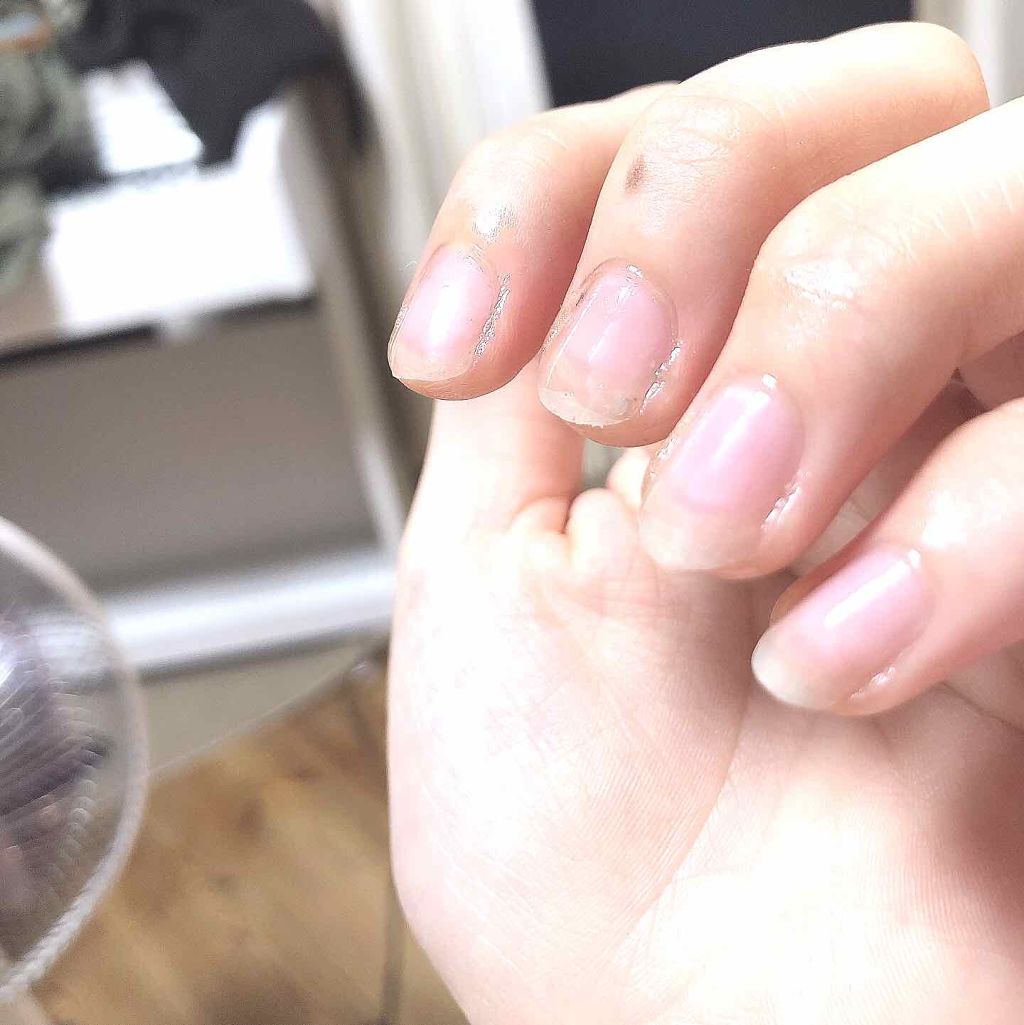 デイケアオイル Dr Nailを使った口コミ 男爪が気になる 爪の周りの皮が裂けてきて By 38 乾燥肌 代前半 Lips