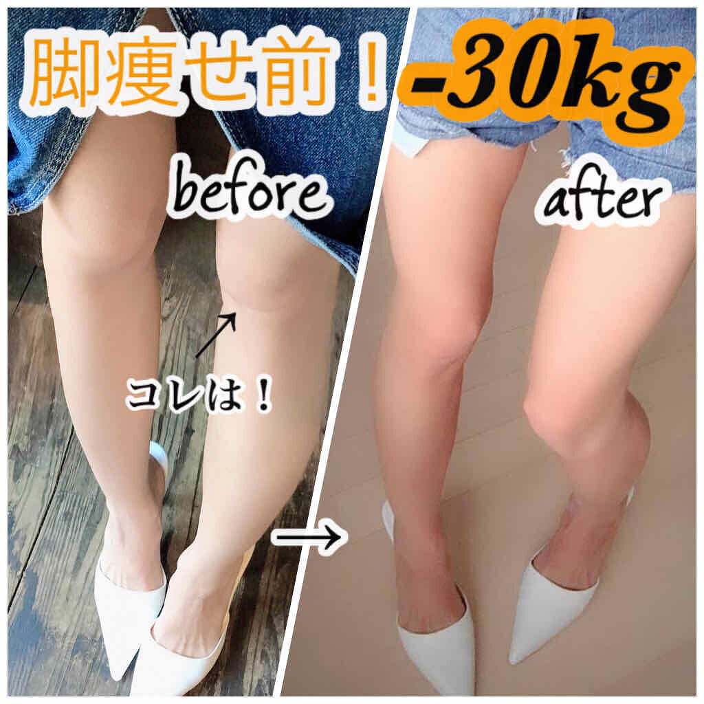 ポッカレモン100 Pokka Sapporo ポッカサッポロ を使った口コミ 短期間 30kg痩せ 足が1番痩せました By Hati 混合肌 Lips