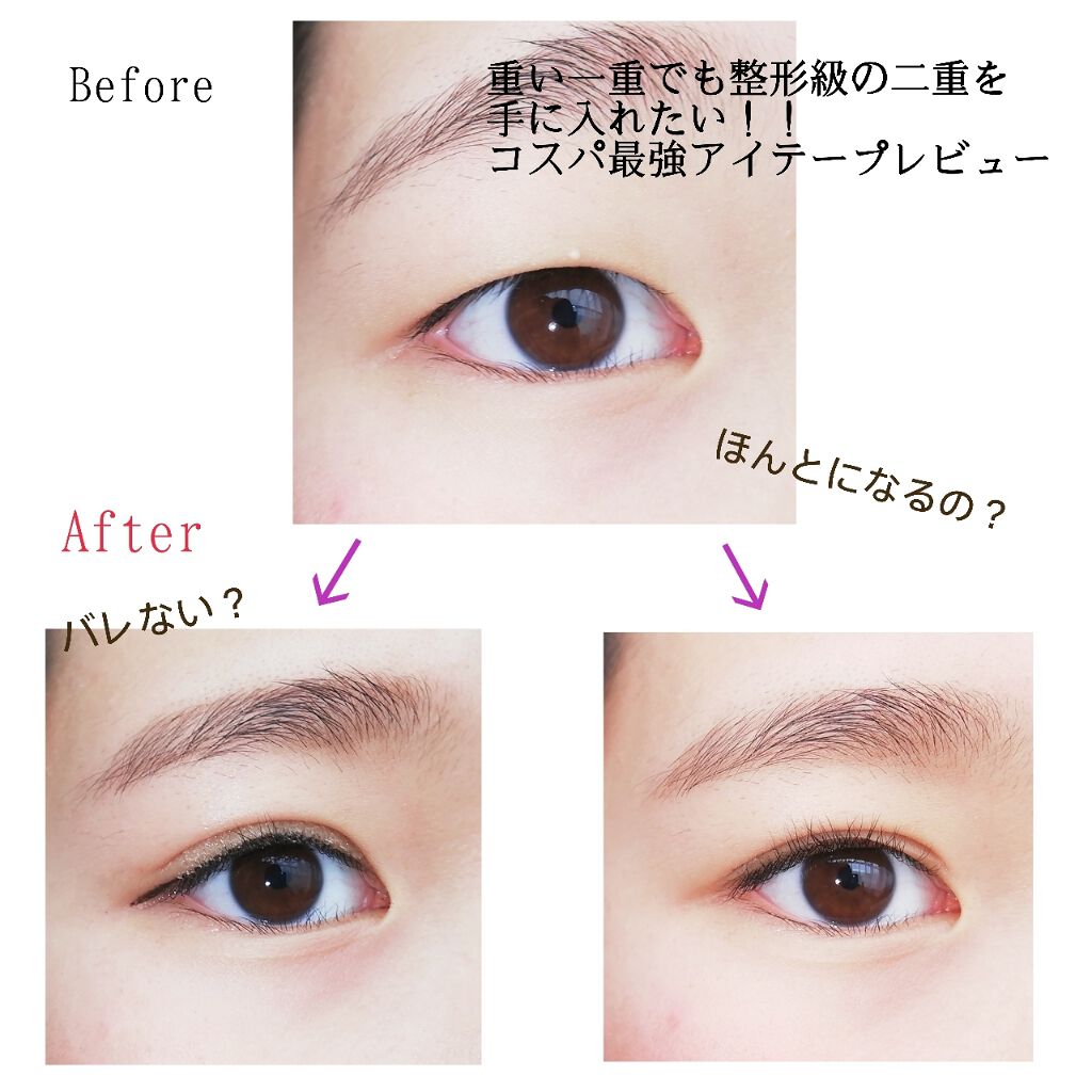 メッシュ アイテープ Shefunを使った口コミ こんにちはkazです 今回は 重い一重で By Kaz 乾燥肌 Lips