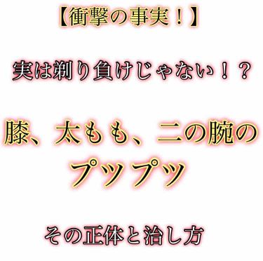 ケアノキュア 医薬品 小林製薬の口コミ 衝撃の事実 実は剃り負けじゃなかった膝裏 By たかぎ 乾燥肌 10代後半 Lips