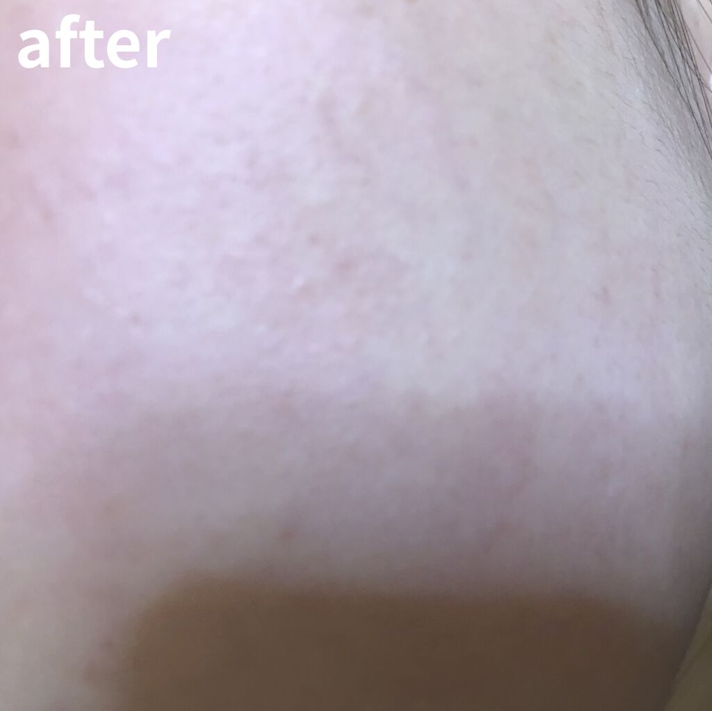 ロゼット洗顔パスタ ホワイトダイヤ ロゼットの効果に関する口コミ こんにちは田舎のjkです ニキビだらけのわ By 田舎のjk 混合肌 10代後半 Lips