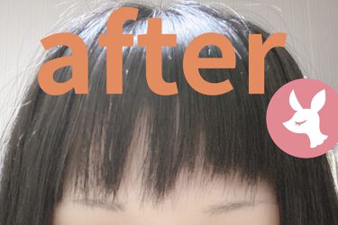 亜鉛 30日分 栄養機能食品 亜鉛 Dhcの口コミ 髪の成長に個人差があることが前提の結果 By ｒｕｒｕ 混合肌 Lips