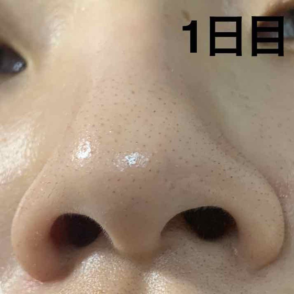 オバジc 酵素洗顔パウダー オバジの口コミ 敏感肌におすすめの洗顔パウダー いちご鼻脱却 酵素洗 By ニカ 敏感肌 代前半 Lips