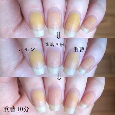 6ステップネイルケア Daisoの口コミ 超優秀 100均で買えるおすすめネイル用品 爪が黄ばんでしまいまし By Hekmatyar 代後半 Lips 6ステップネイルケア Daisoの口コミ 超優秀 100均で買えるおすすめネイル用品 爪が黄ばんでしまいまし By Hekmatyar 代後半 Lips