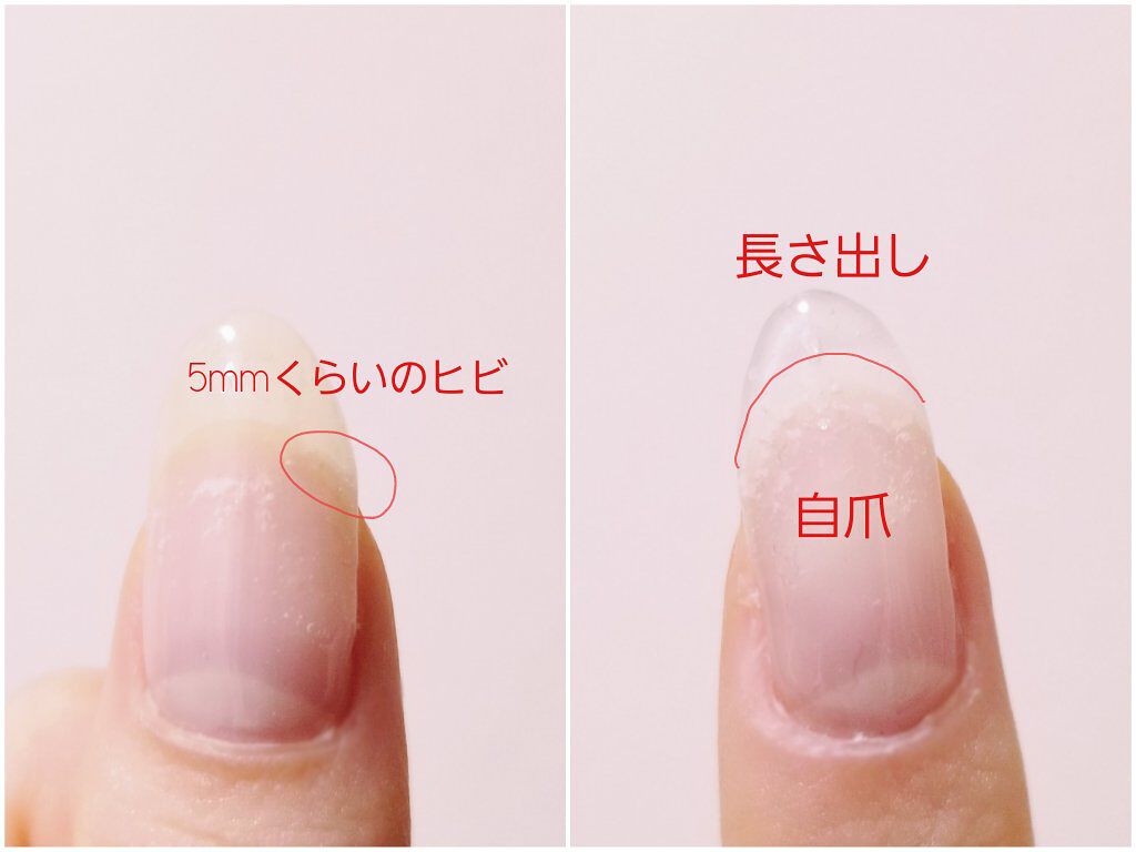 Shジェルネイル ライト対応 セリアを使った口コミ 爪が割れた時の治し方 ネイルの映える爪 By あお 乾燥肌 代前半 Lips