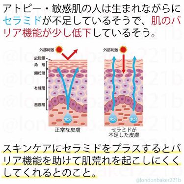 まるまる美容液 プロテオグリカン ビューティゲートの口コミ 敏感肌におすすめの美容液 子供の頃からアトピー性 By Er 石鹸オフコスメblog Lips