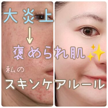 年代 肌質別 薬用洗顔フォーム スキンライフの口コミ 641件 Lips