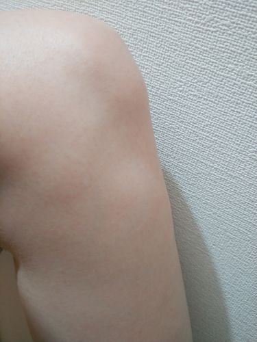 フェリエ フェイス用 Es Wf40 Panasonicを使った口コミ 学生時代のポツポツ毛穴を消し去った方法 By Cocoa スキンケア収集癖 敏感肌 代後半 Lips