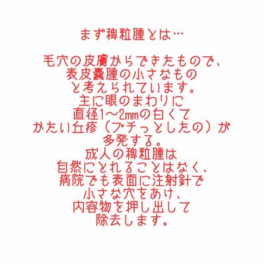 送った オートメーション 移行する 稗 粒 腫 ピーリング Unifood Inc Jp