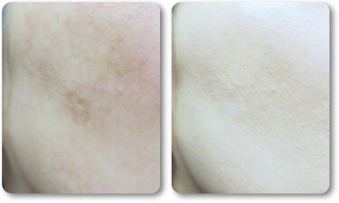 アルーチェルーチェ クッションファンデーション Aluce Luceの口コミ 美容液 日焼け止め 化粧下地 ファンデーシ By いちごみるく 混合肌 Lips