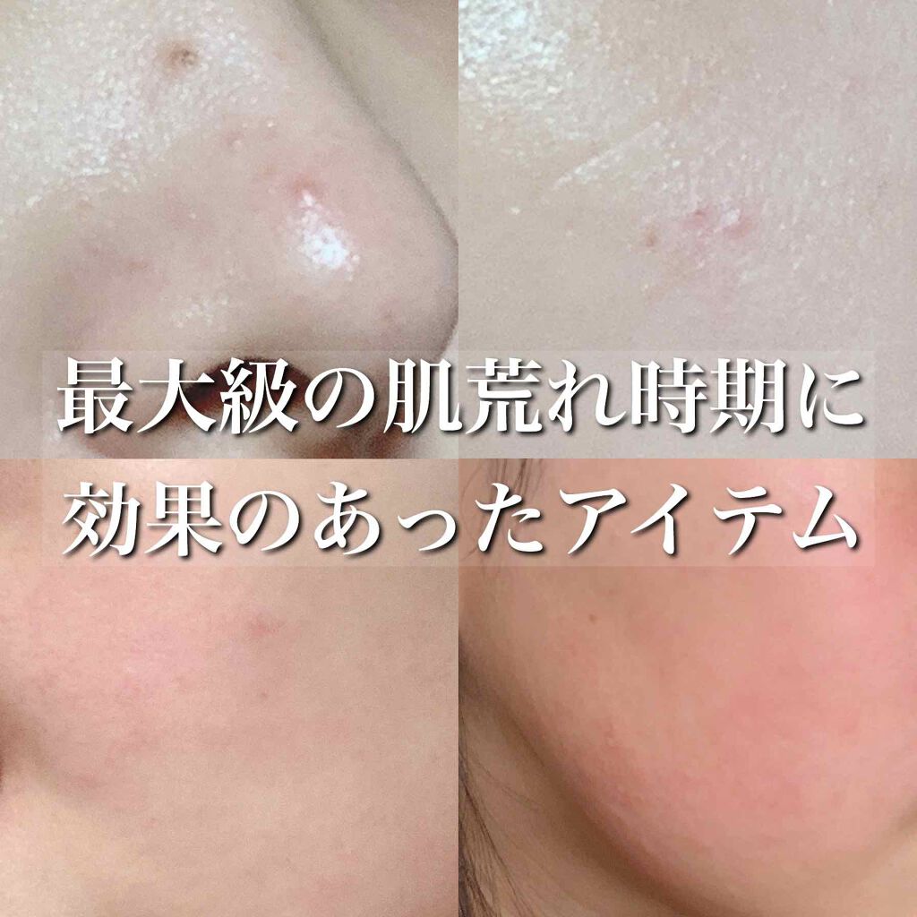 スキンケア方法 マデカソ Cicaクリーム A Pieuの使い方 効果 By Koyagi 乾燥肌 代後半 Lips