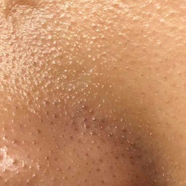 ホホバオイル 無印良品の口コミ 画像閲覧注意です 汚すぎます 私が8月から By りん 脂性肌 10代後半 Lips