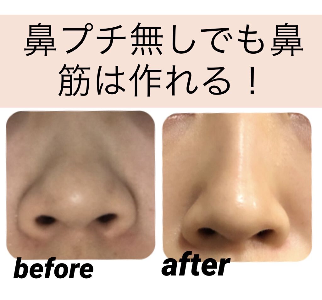 小顔ローラー Daisoを使った口コミ 鼻プチ無しで鼻の形は変えられる 鼻をどうに By いくら 混合肌 10代後半 Lips