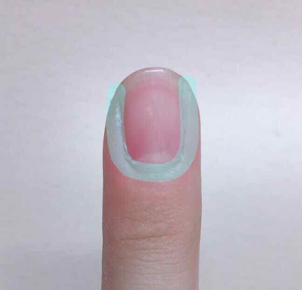 オリジナル ピュアスキンジェリー ヴァセリンの口コミ ネイルベッド伸ばそう １ヶ月で 約1 2 By 吾輩はくまである 混合肌 10代後半 Lips