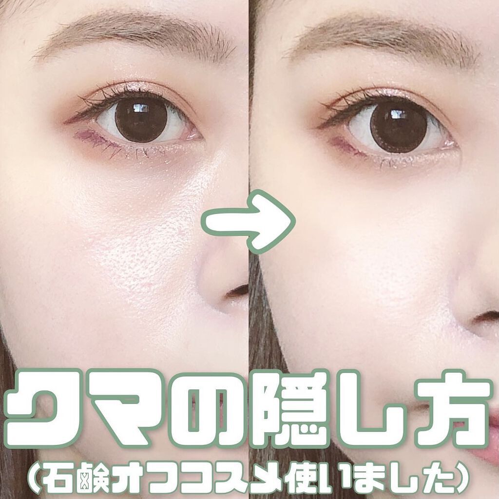 目の下のくまを何とかしたい!【原因別の改善方法やきれいにカバーできる優秀アイテムも】のサムネイル