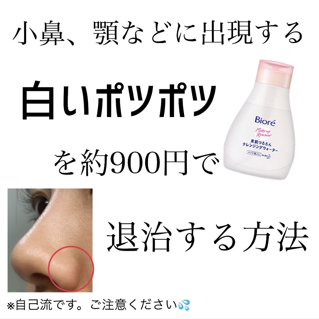 素肌つるるんクレンジングウォーター ビオレを使った口コミ 1回で小鼻の白いプツプツが消えました By おらまる 混合肌 代前半 Lips