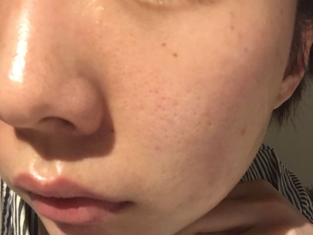 Massage Face Wash 中性重炭酸洗顔パウダー Barthの口コミ 敏感肌におすすめの洗顔パウダー 洗顔後すぐにピカピカ肌 By A 敏感肌 代後半 Lips