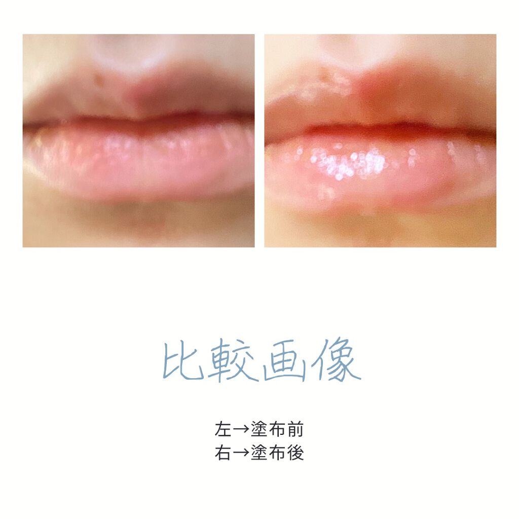 リップ美容液 Whomeeの口コミ フーミーリップ美容液8g 1 300円 By Yochan フォロバ100 乾燥肌 代後半 Lips