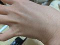 間宮 アロエ軟膏 医薬品 アロエ製薬のリアルな口コミ レビュー Lips