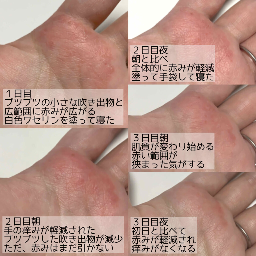 白色ワセリン 医薬品 日本薬局方の口コミ 今回ご紹介するのは 日本薬局方白色ワセリン By Sk 30代前半 Lips