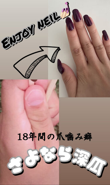 ネイルエンビー O P Iを使った口コミ 私は深爪だからネイルできない 爪を噛む癖 By はなまる フォロー返します 乾燥肌 10代後半 Lips