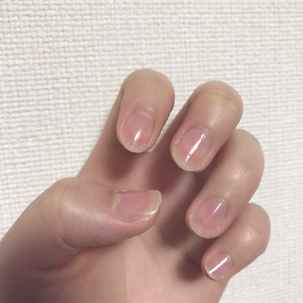 ディーアップファンデーション D Upの口コミ D Upネイルファンデーションモニターでい By B B 代前半 Lips