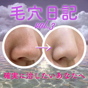 スキンケア方法 サヴォン ド マルセイユ オリーブ石鹸 ル セライユの使い方 効果 By 𝐜𝐡𝐢𝐦 代前半 Lips