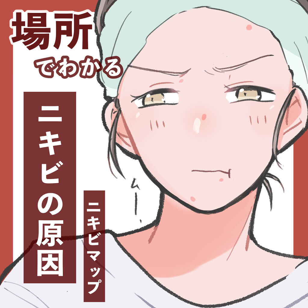 ペアアクネクリームw 医薬品 ペアを使った口コミ 場所でわかるニキビの原因 ニキビマ By ゆうひちゃん 絵描き 乾燥肌 Lips