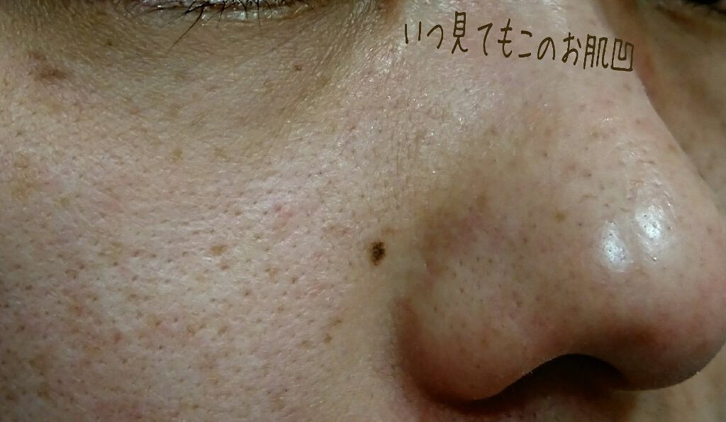 デュオ ザ クレンジングバーム クリア Duoの口コミ 毛穴が憎い Lipsユーザーの皆様こんば By はな 乾燥肌 30代前半 Lips