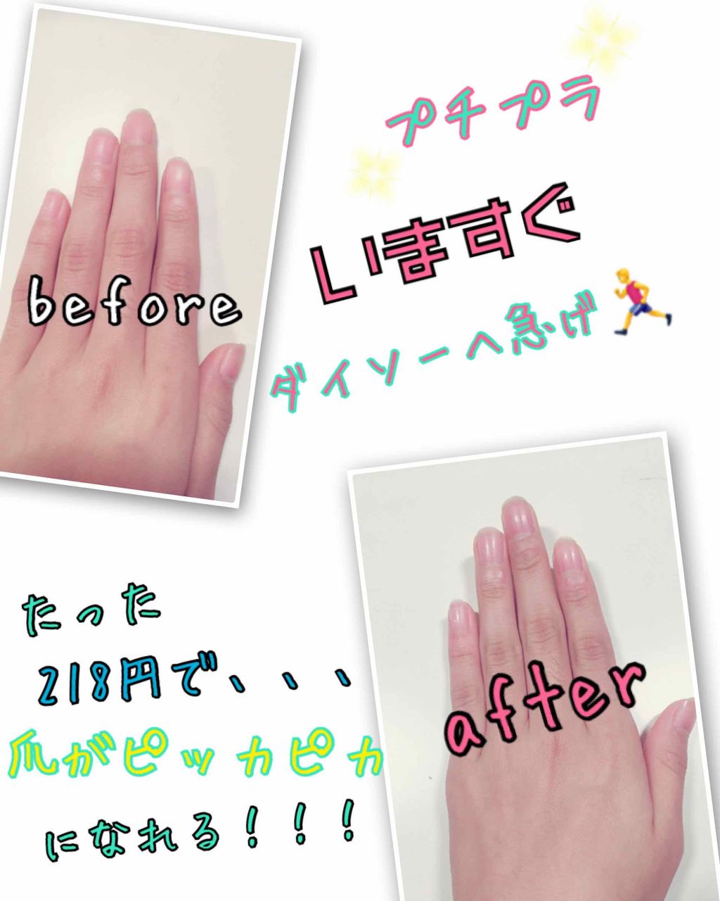 ガラス爪ヤスリ Daisoを使った口コミ こんにちはsorairoです 今回紹介す By Sorairo 混合肌 10代前半 Lips