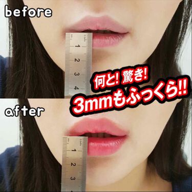 Spicy Lip Pump Hotomiの口コミ Hotomi スパイシーリッププランプ By りか 乾燥肌 代前半 Lips