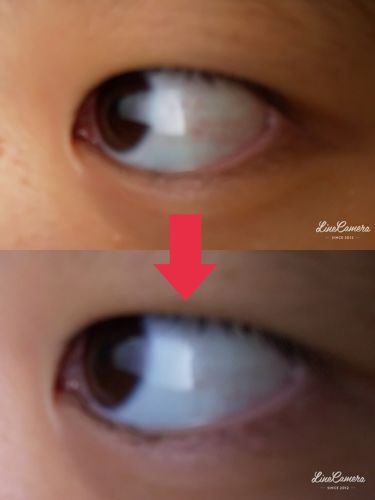 ロートリセ 医薬品 ロート製薬の口コミ こんにちは いちご です 速報 いちご By いちご 普通肌 10代前半 Lips