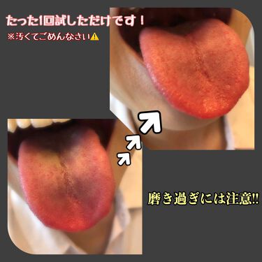 効果 舌 磨き 舌(ベロ)トレで万病予防！