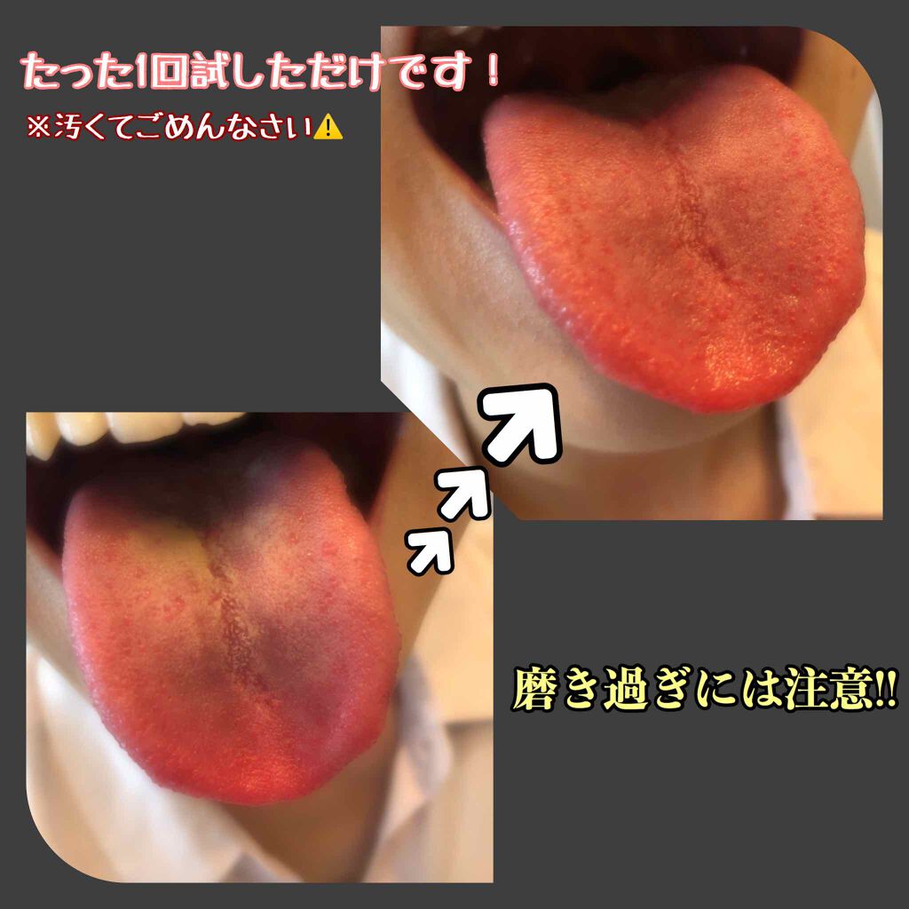 Nonio 舌クリーナー Nonioを使った口コミ 3枚目写真舌磨きのbefore Afte By でいじー 乾燥肌 代後半 Lips