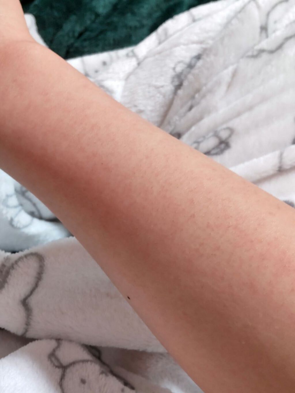 脱毛クリーム Moomo 自然化粧品研究所の画像 動画一覧 Lips