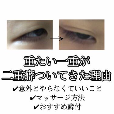 ダブルアイリキッド Abを使った口コミ 左は1年前くらい 右は最近のなにもしてない By やや 混合肌 10代後半 Lips