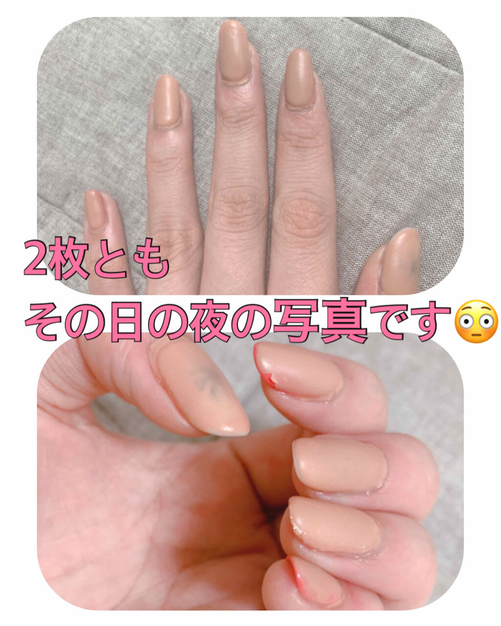 ピールオフマニキュア キャンドゥの口コミ 超優秀 100均で買えるおすすめマニキュア キャンドゥピールオフ By ちゃん 混合肌 代後半 Lips