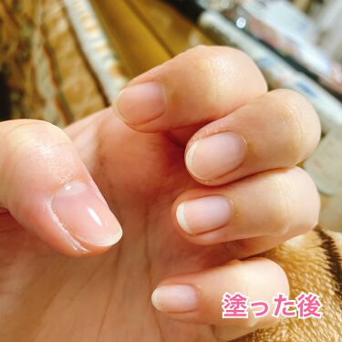 デイケアオイル Dr Nailを使った口コミ 一旦ジェルネイルをお休みしたくてオフしてき By みみみ 混合肌 代後半 Lips