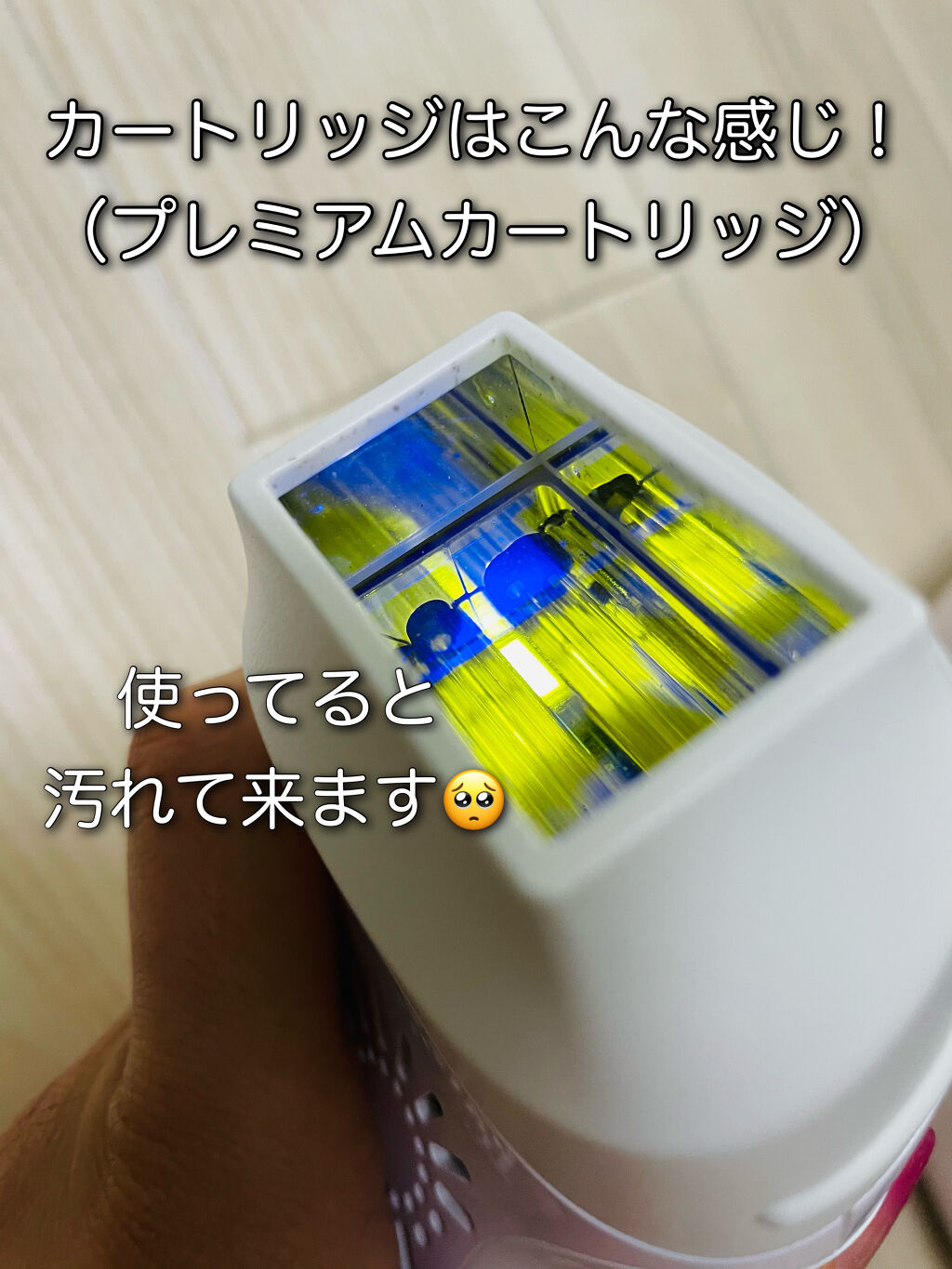 家庭用脱毛器 ケノン Ke Non エムテックを使った口コミ こんにちは ひらりんです 今日は脱毛器ケ By ひらりん 普通肌 代前半 Lips
