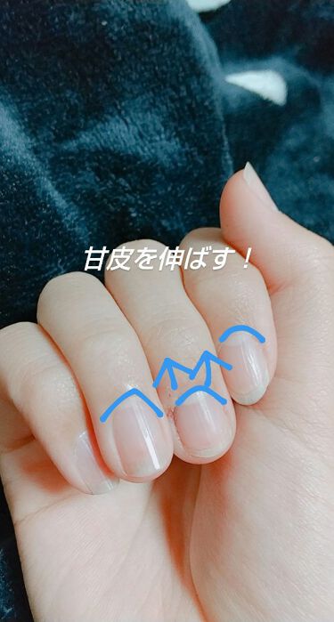 ニベアクリーム ニベアを使った口コミ 深爪だった私が 今回は深爪だっ By あず アトピー肌 Lips
