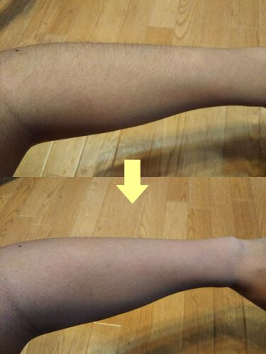 パイナップル豆乳除毛クリーム 鈴木ハーブ研究所の使い方を徹底解説 今日は私が使っている脱毛クリームについてで By 鳳梨 フォロバ100 敏感肌 10代後半 Lips