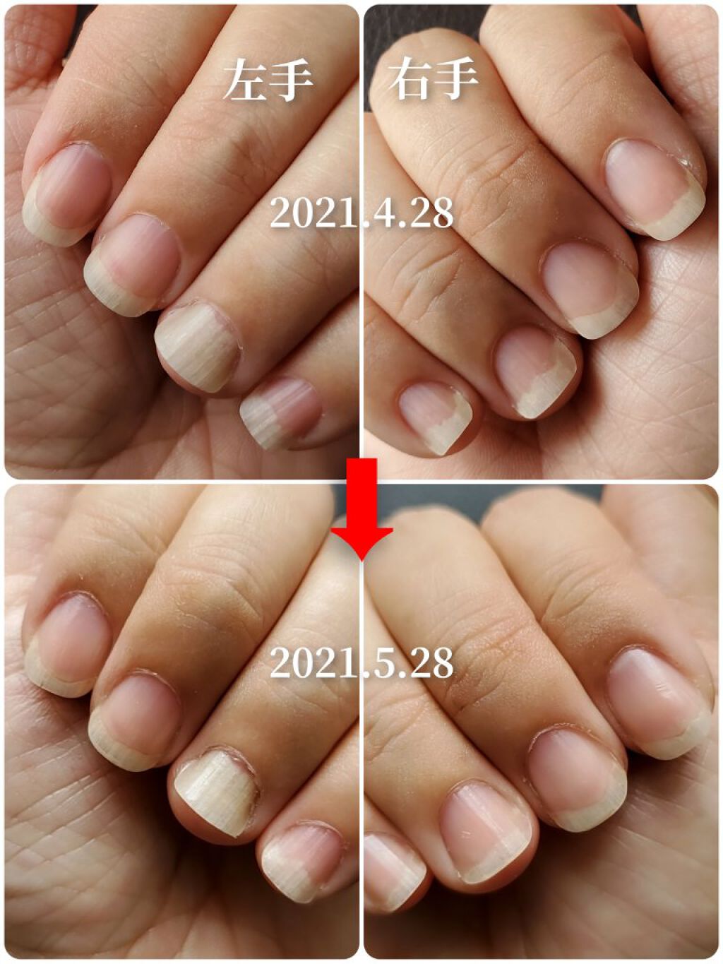 クイックケアコート Ettusaisの口コミ 爪甲剥離症の育爪記録以前の投稿はこちらに By かぴめろん 乾燥肌 40代後半 Lips