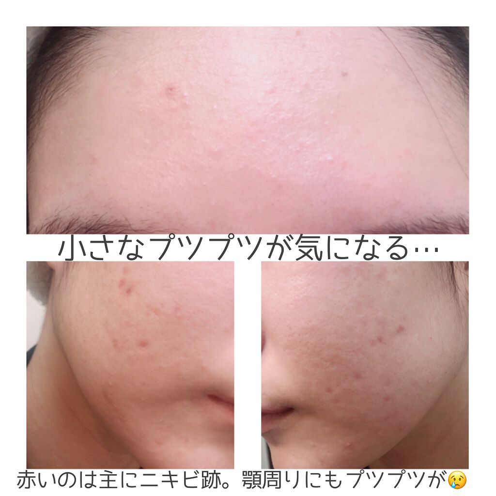 ヒルメナイド油性クリーム 医薬品 Matsukiyoの画像 動画一覧 Lips